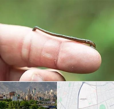 مرکز زالو درمانی در جمشیدیه