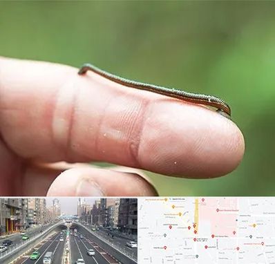 مرکز زالو درمانی در توحید