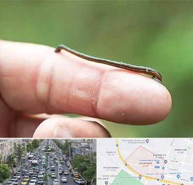 مرکز زالو درمانی در گلشهر کرج