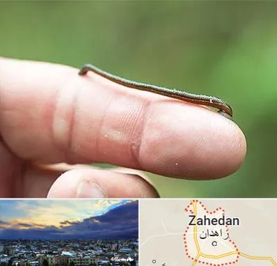 مرکز زالو درمانی در زاهدان