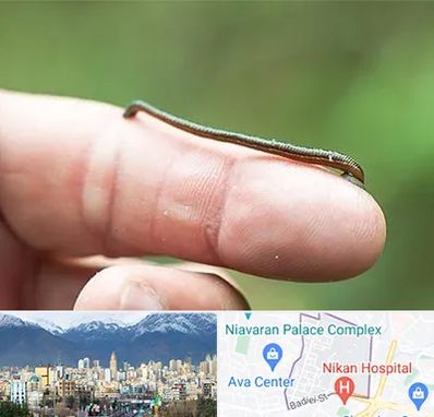 مرکز زالو درمانی در آجودانیه