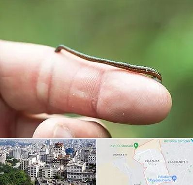 مرکز زالو درمانی در ولنجک