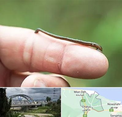 مرکز زالو درمانی در چالوس