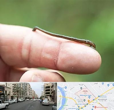 مرکز زالو درمانی در زیتون کارمندی اهواز