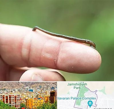 مرکز زالو درمانی در نیاوران