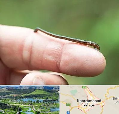 مرکز زالو درمانی در خرم آباد