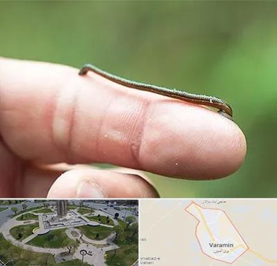 مرکز زالو درمانی در ورامین