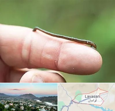 مرکز زالو درمانی در لواسان