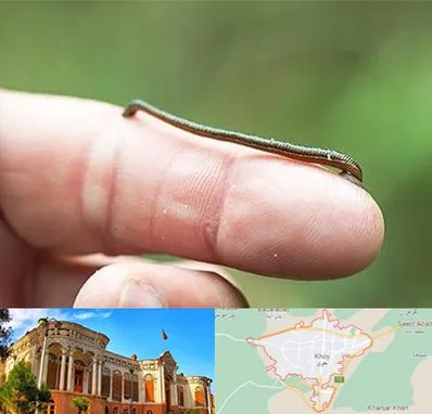 مرکز زالو درمانی در خوی