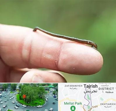 مرکز زالو درمانی در تجریش