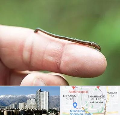 مرکز زالو درمانی در شهرک غرب