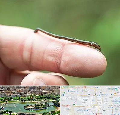 مرکز زالو درمانی در منطقه 9 تهران