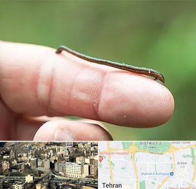 مرکز زالو درمانی در مرزداران