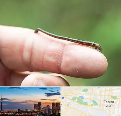 مرکز زالو درمانی در غرب تهران