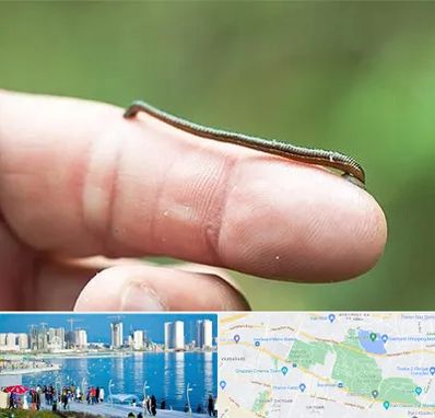 مرکز زالو درمانی در چیتگر