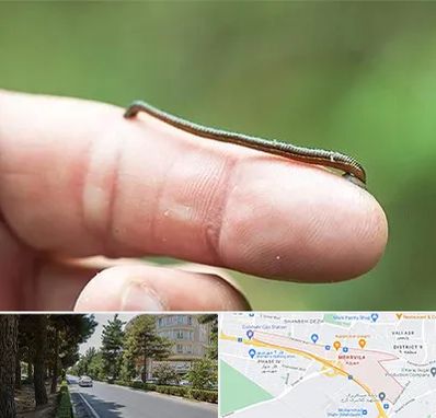 مرکز زالو درمانی در مهرویلا کرج