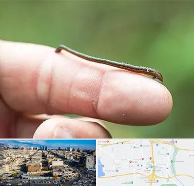 مرکز زالو درمانی در شهرک راه آهن