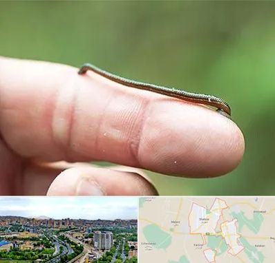 مرکز زالو درمانی در شهریار