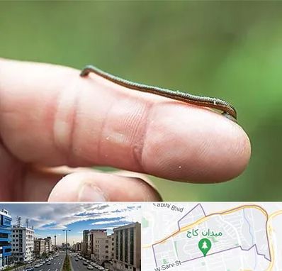 مرکز زالو درمانی در سعادت آباد