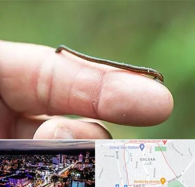 مرکز زالو درمانی در گلسار رشت