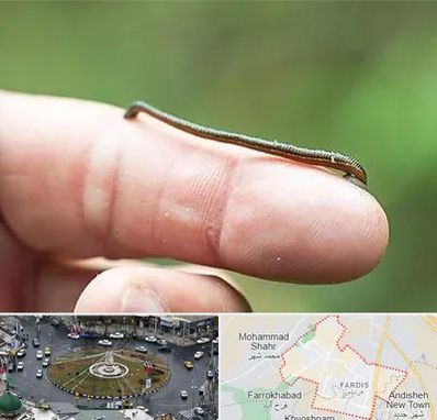 مرکز زالو درمانی در فردیس کرج