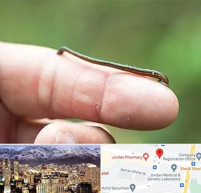 مرکز زالو درمانی در جردن