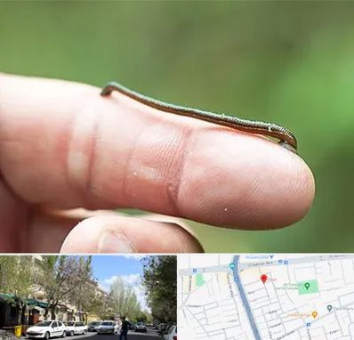 مرکز زالو درمانی در کوی فیروز تبریز