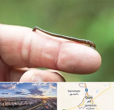 مرکز زالو درمانی در قم