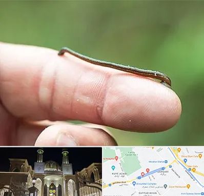 مرکز زالو درمانی در زرگری شیراز