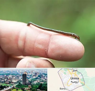 مرکز زالو درمانی در ارومیه