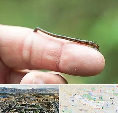 مرکز زالو درمانی در منطقه 21 تهران