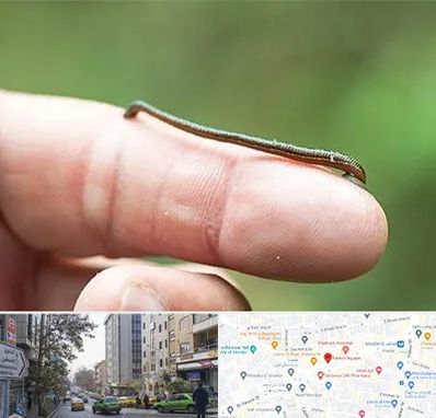 مرکز زالو درمانی در فاطمی