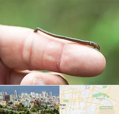 مرکز زالو درمانی در شرق تهران