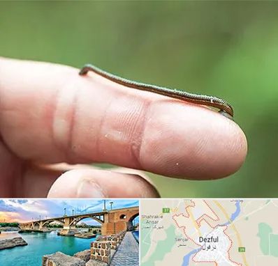 مرکز زالو درمانی در دزفول