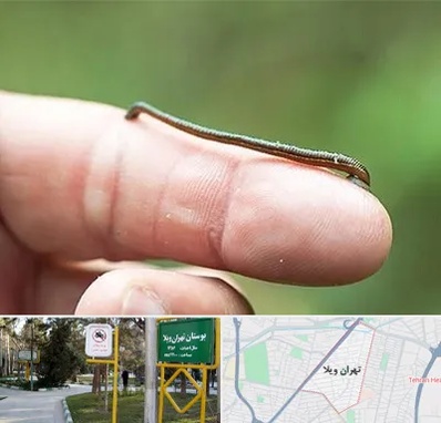 مرکز زالو درمانی در تهران ویلا