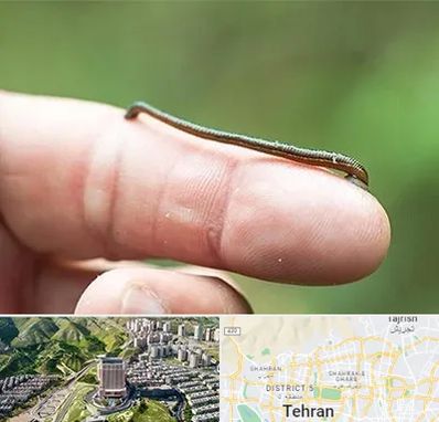 مرکز زالو درمانی در شمال تهران