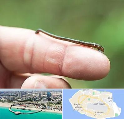 مرکز زالو درمانی در کیش