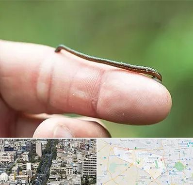 مرکز زالو درمانی در منطقه 18 تهران