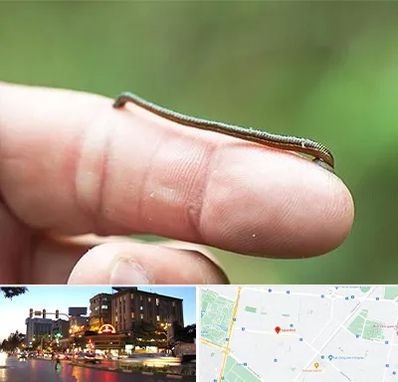 مرکز زالو درمانی در بلوار سجاد مشهد