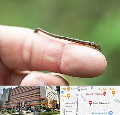 مرکز زالو درمانی در سهروردی