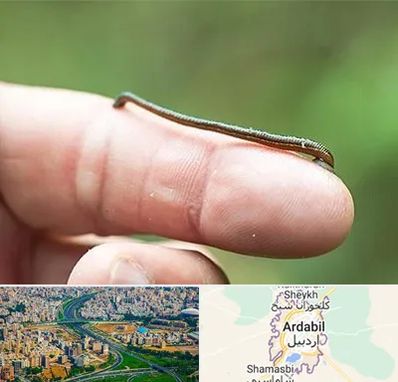 مرکز زالو درمانی در اردبیل