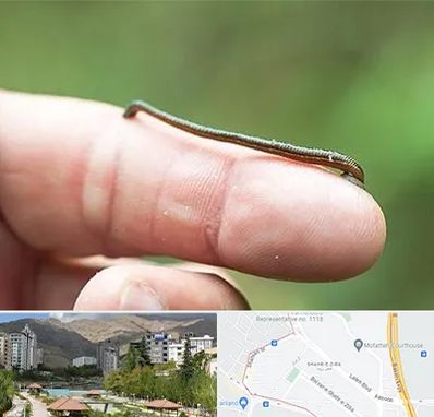 مرکز زالو درمانی در شهر زیبا