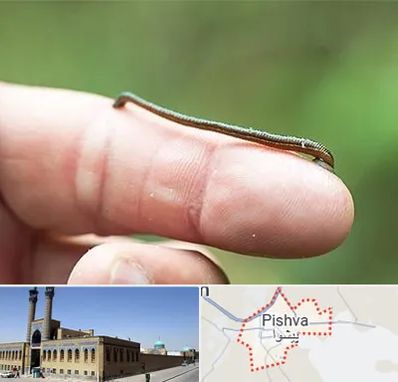 مرکز زالو درمانی در پیشوا