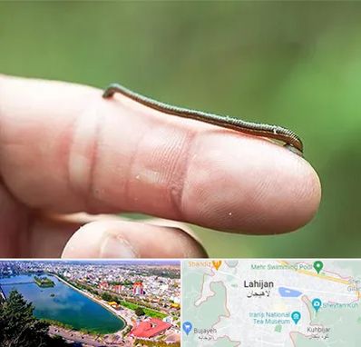 مرکز زالو درمانی در لاهیجان