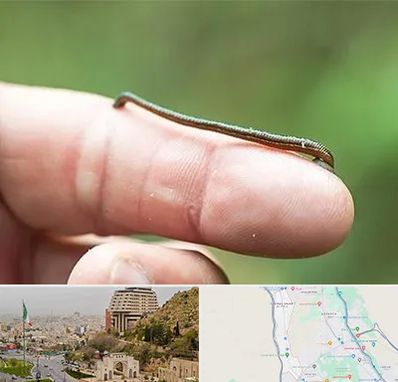 مرکز زالو درمانی در فرهنگ شهر شیراز