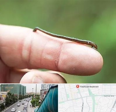 مرکز زالو درمانی در بلوار فرحزادی