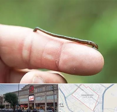 مرکز زالو درمانی در قائمیه اسلامشهر