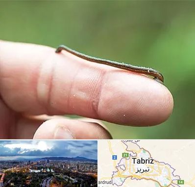 مرکز زالو درمانی در تبریز