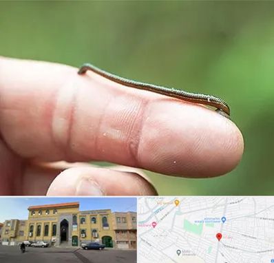 مرکز زالو درمانی در زنبیل آباد قم