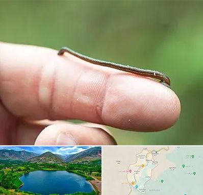 مرکز زالو درمانی در رودبار